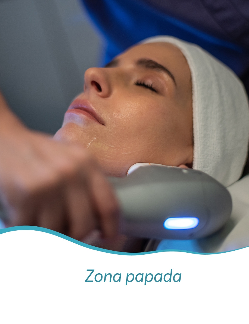 HIFU 25D Lifting y rejuvenecimiento Facial